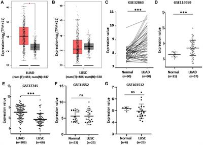 CD73 Severed as a Potential Prognostic Marker and Promote Lung Cancer Cells Migration via Enhancing EMT Progression